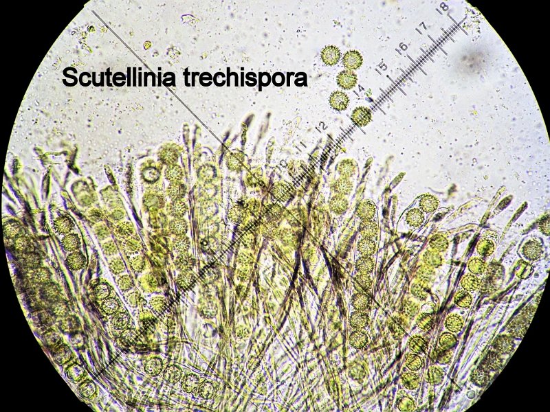 Scutellinia trechispora-amf103-micro.jpg